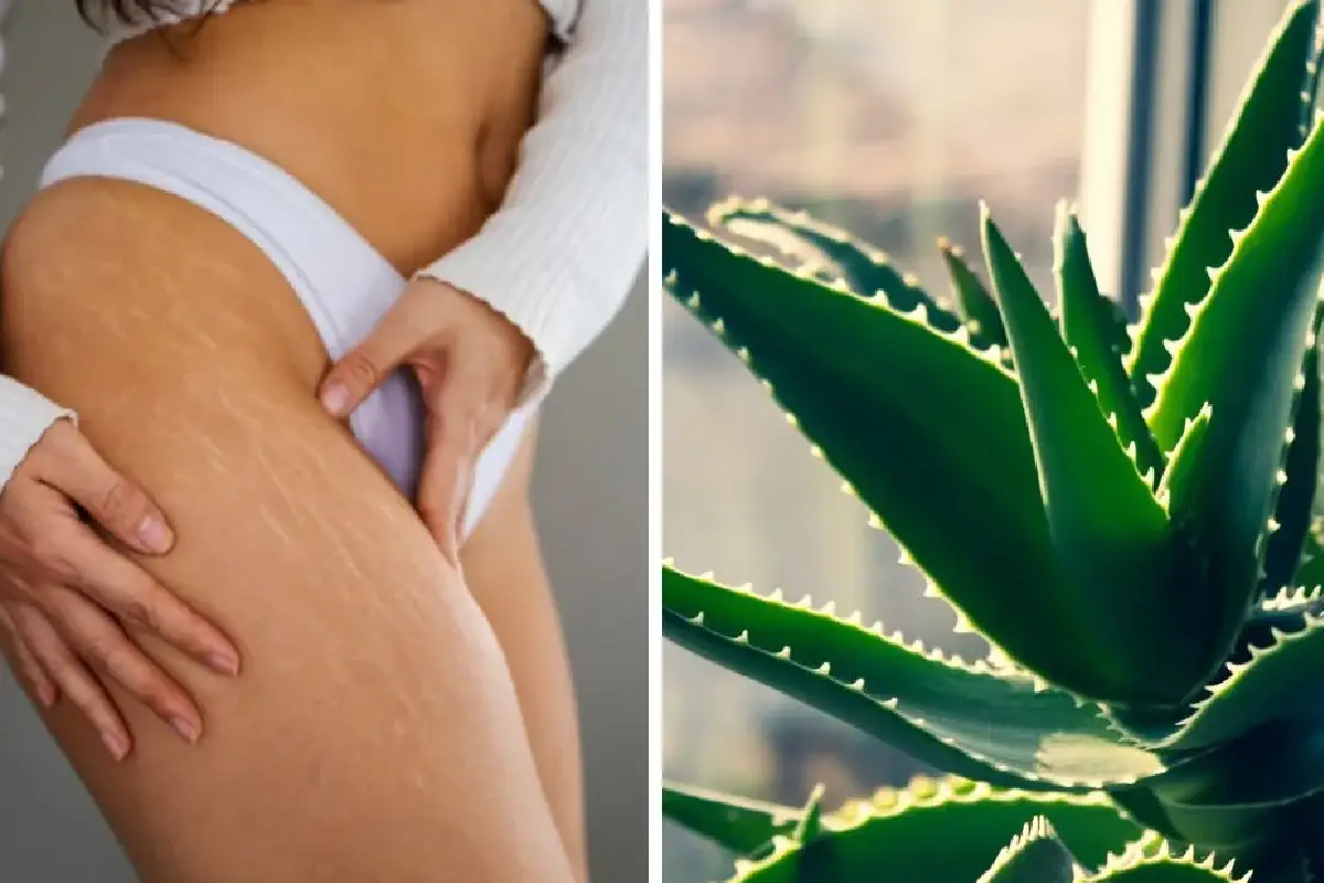 Preparato Naturale con Aloe Vera per Ridurre le Smagliature su Tutto il Corpo