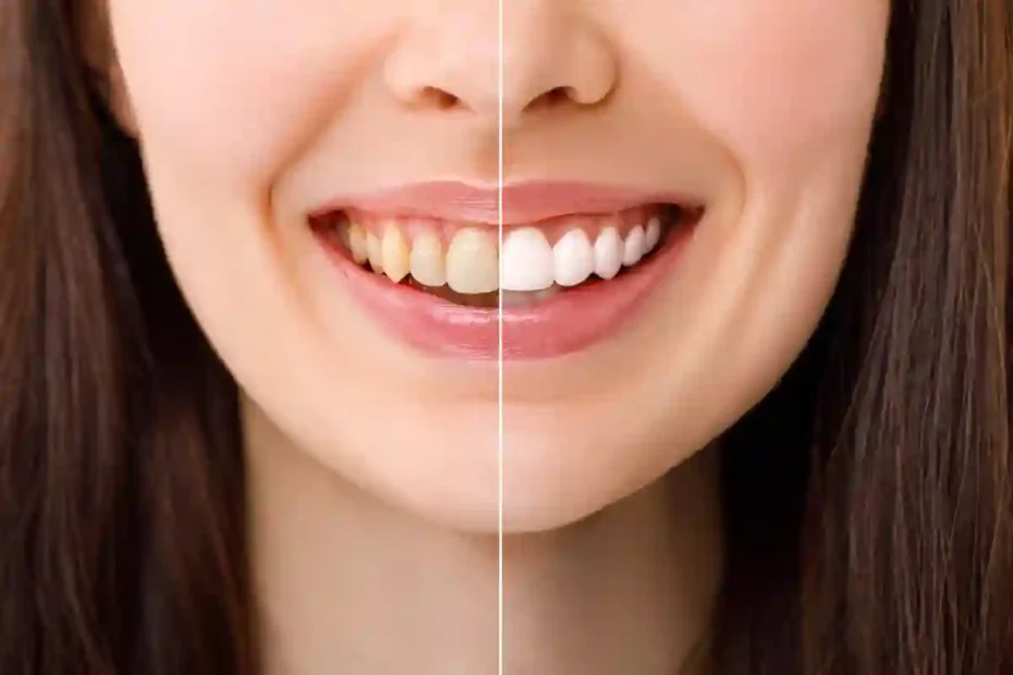L’Ingrediente Definitivo per Avere Denti Più Bianchi e un Sorriso Perfetto